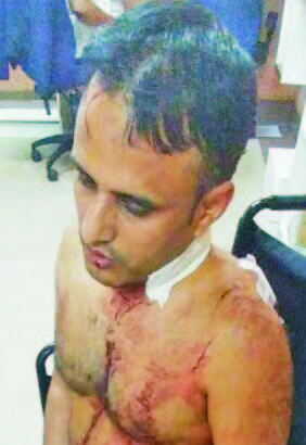 Agra Street East resident brutally stabbed after leaving mosque