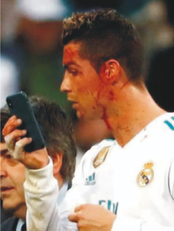 Zidane: Why Ronaldo Grabbed Phone After Facial Injury