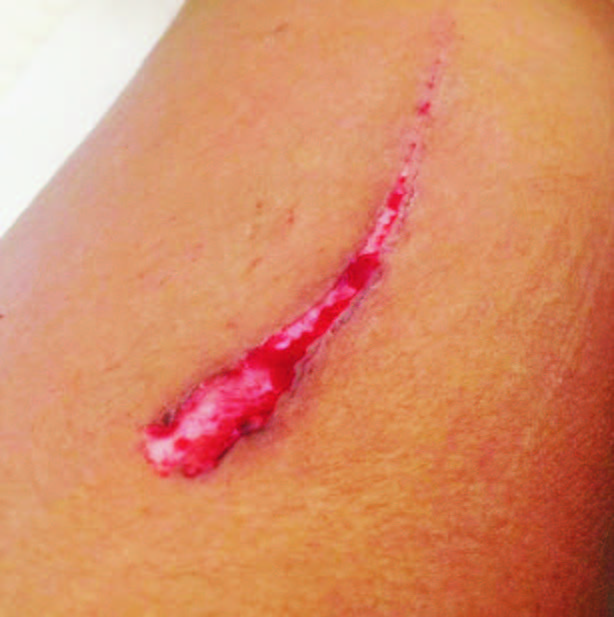 Family member accused of stabbing mother & daughter!
