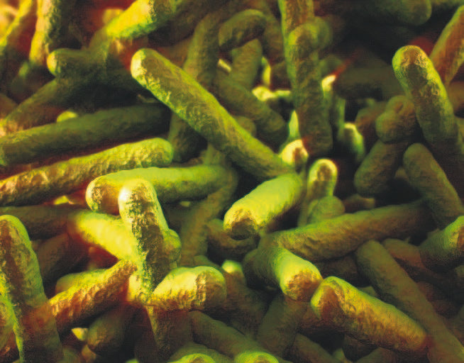 WHO: South Africa dealing with ‘largest ever’ Listeria outbreak